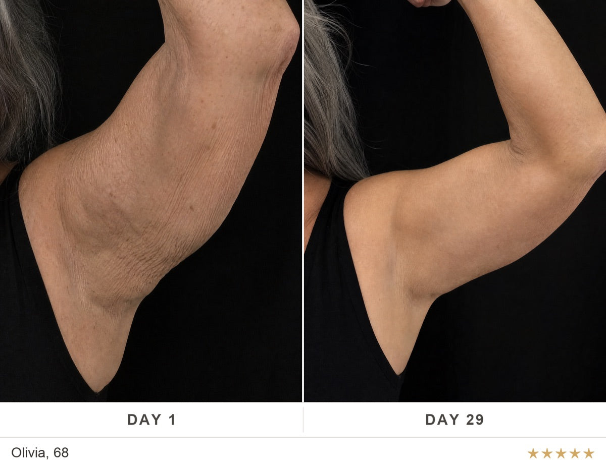 Before and after, Olivia