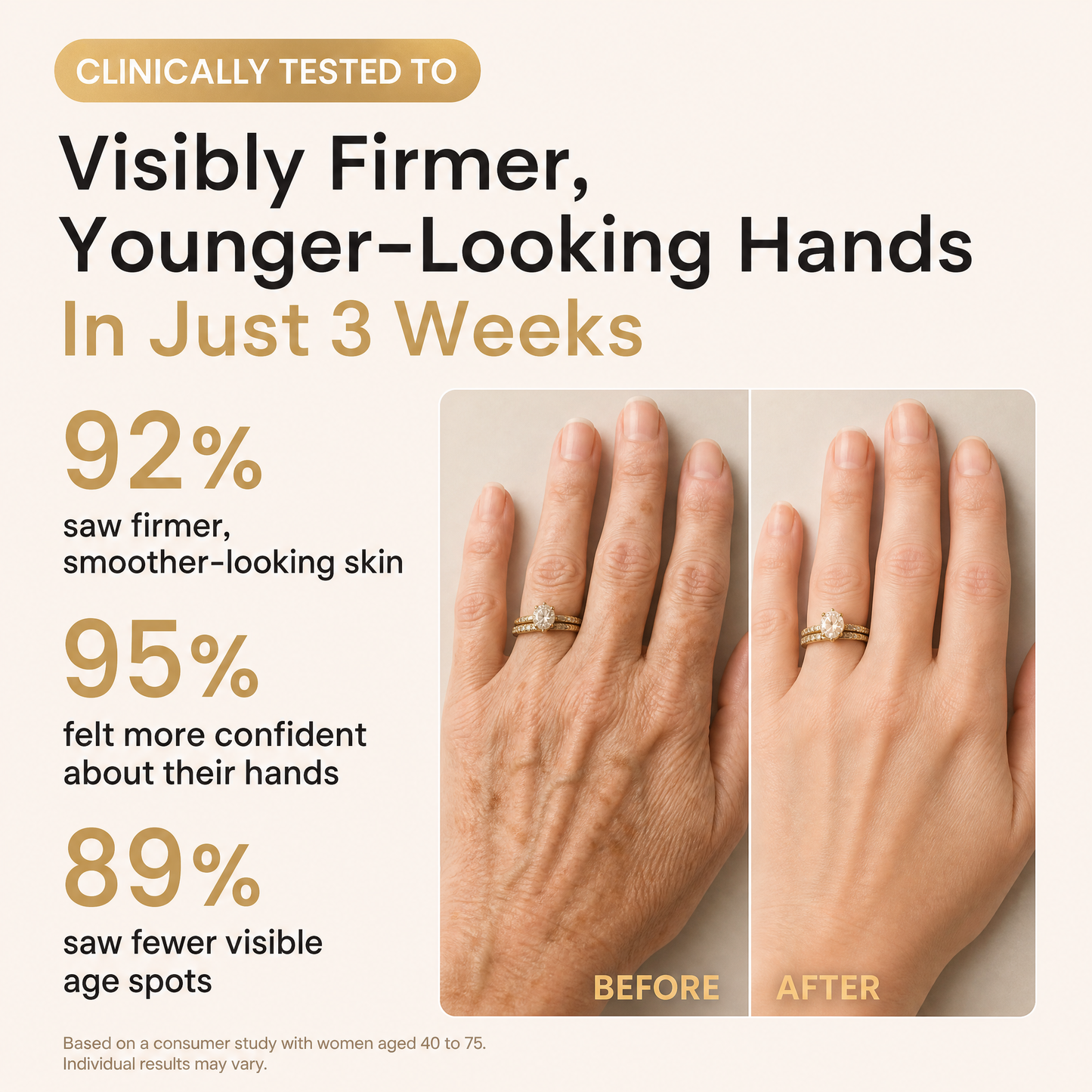 YouthLift™ Retinol Skin Cream