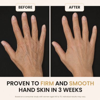 YouthLift™ Retinol Skin Cream
