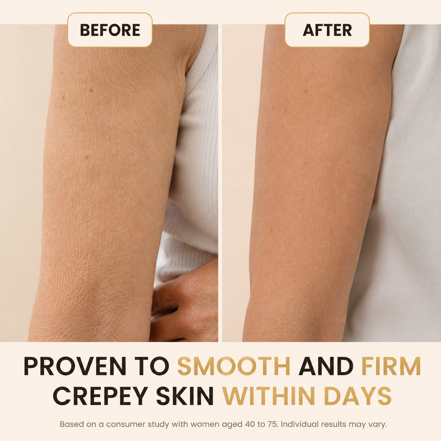 YouthLift™ Retinol Skin Cream