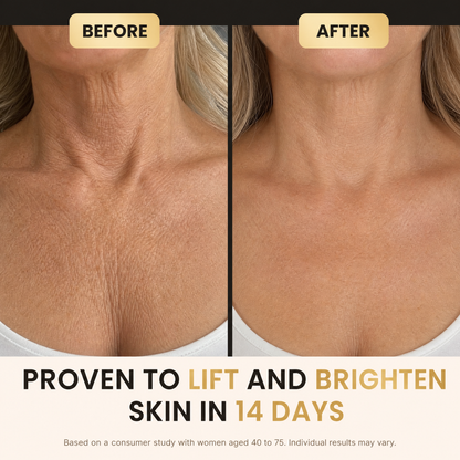 YouthLift™ Retinol Skin Cream