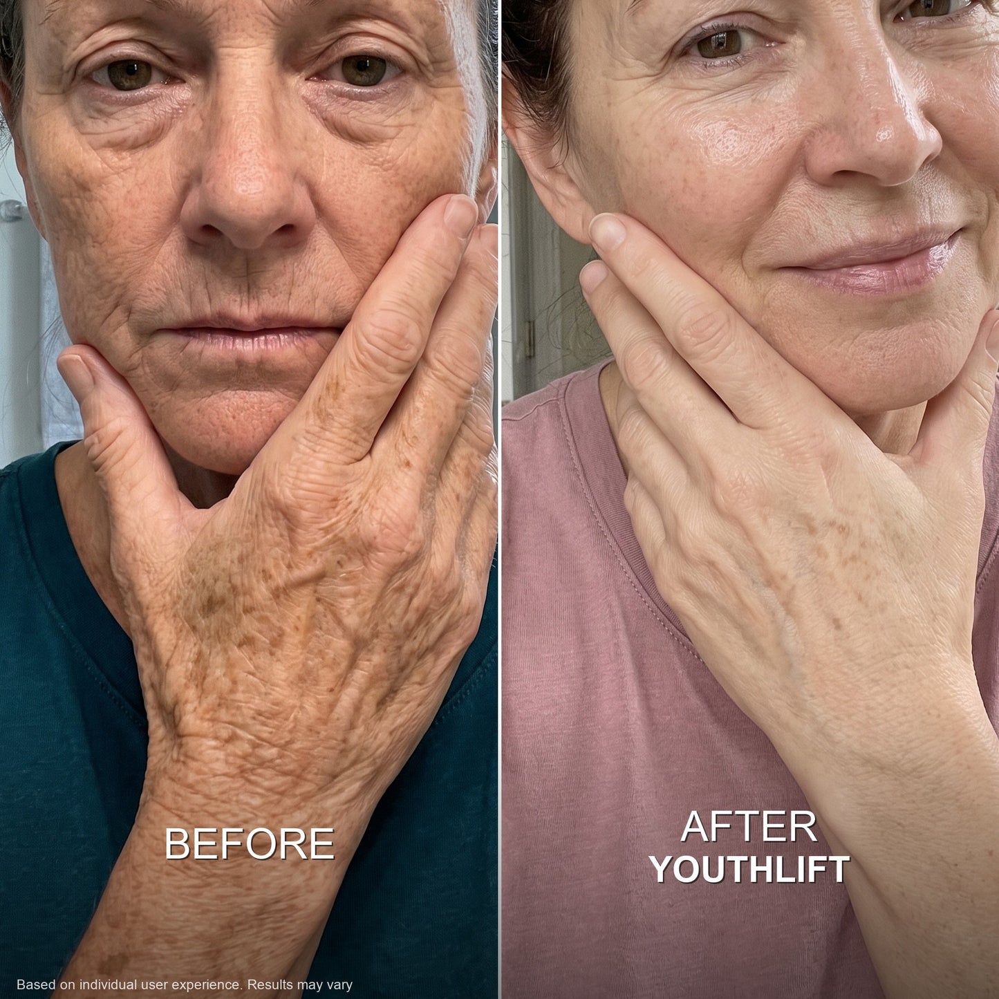 YouthLift™ Retinol Skin Cream