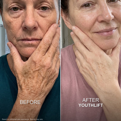 YouthLift™ Retinol Skin Cream