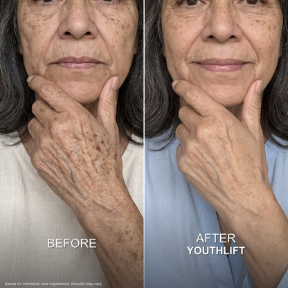 YouthLift™ Retinol Skin Cream