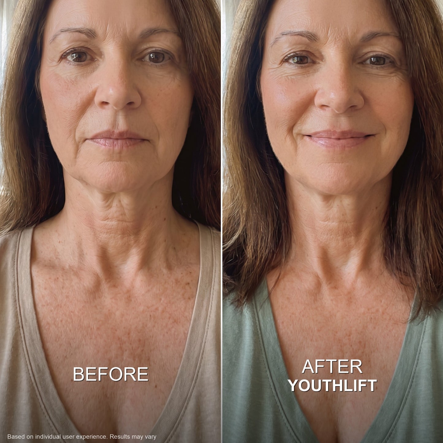 YouthLift™ Retinol Skin Cream