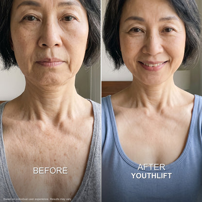 YouthLift™ Retinol Skin Cream