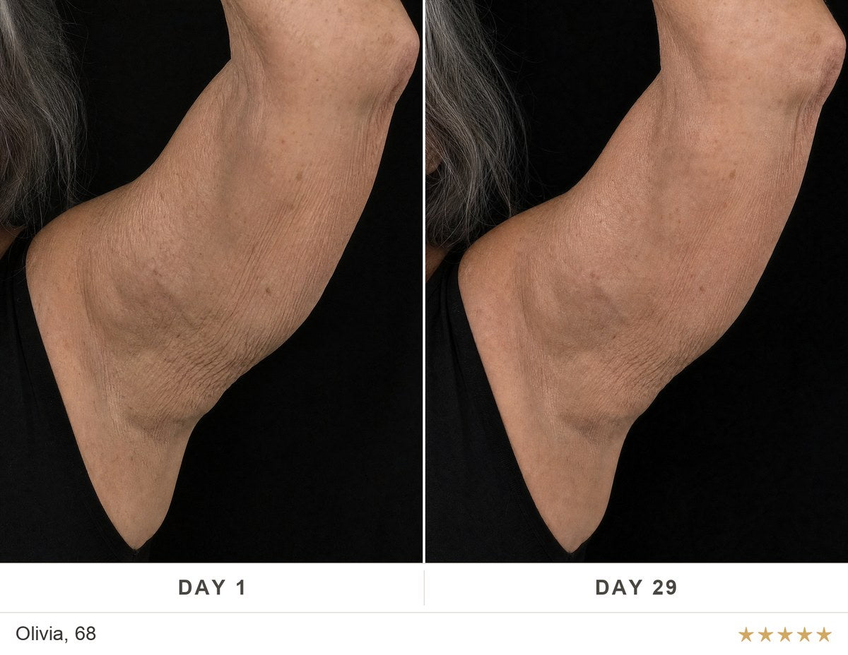 Before and after, Olivia