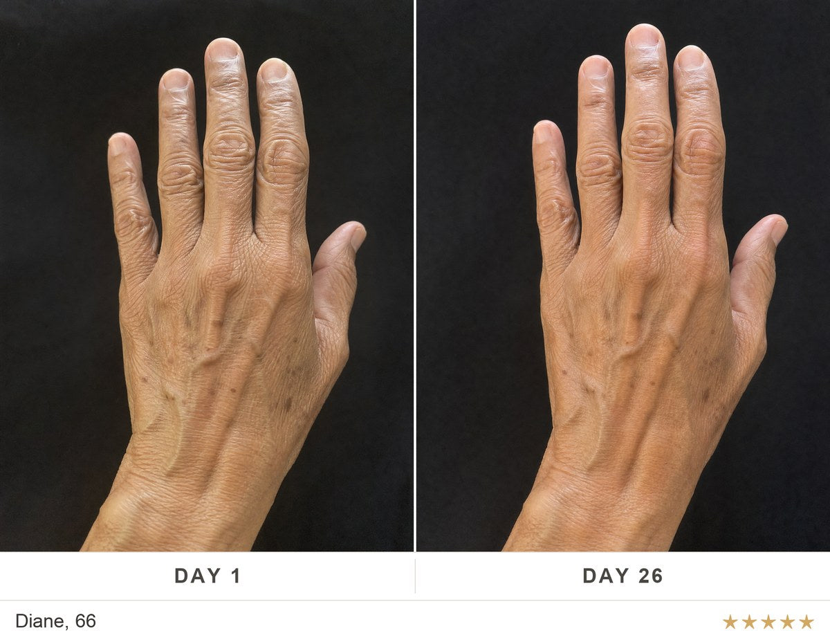 Before and after, Diane