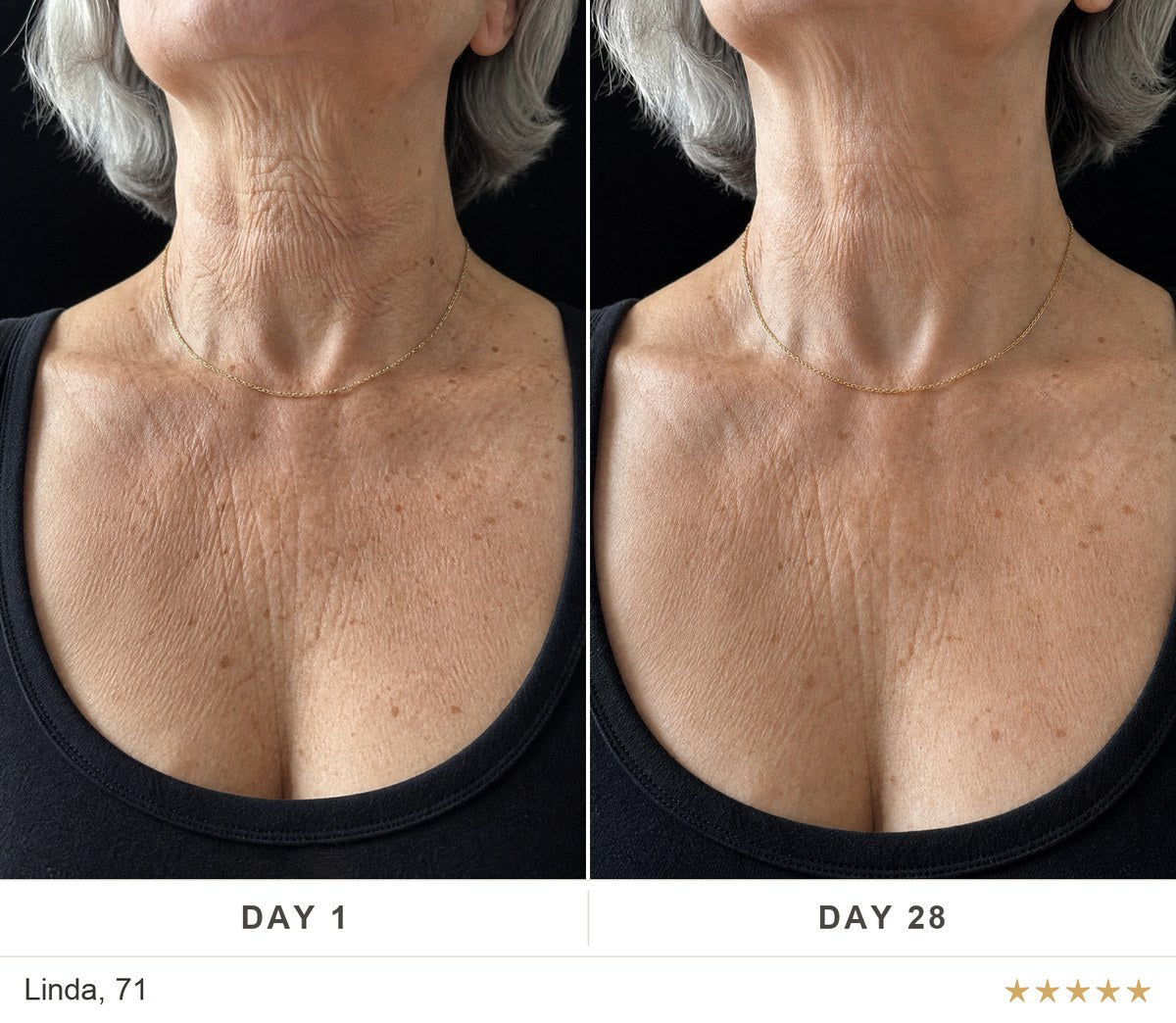 Before and after, Linda