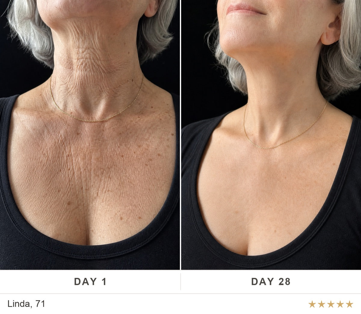 Before and after, Linda