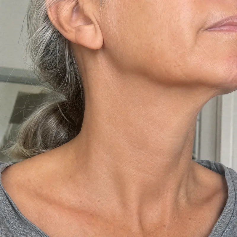Neck after Plumessa