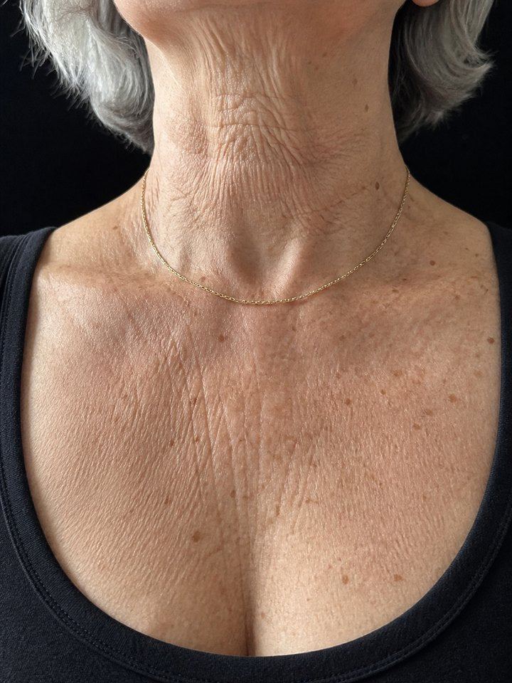 Crepey neck and décolletage before using YouthLift