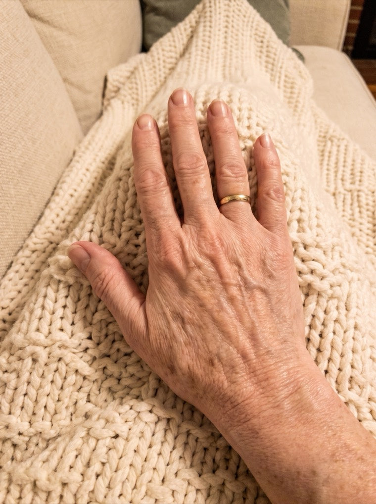 Carol's smoother hand after using YouthLift