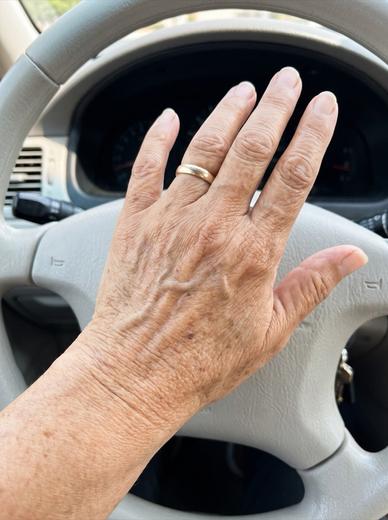 Rosa's smoother, plumper hand after using YouthLift