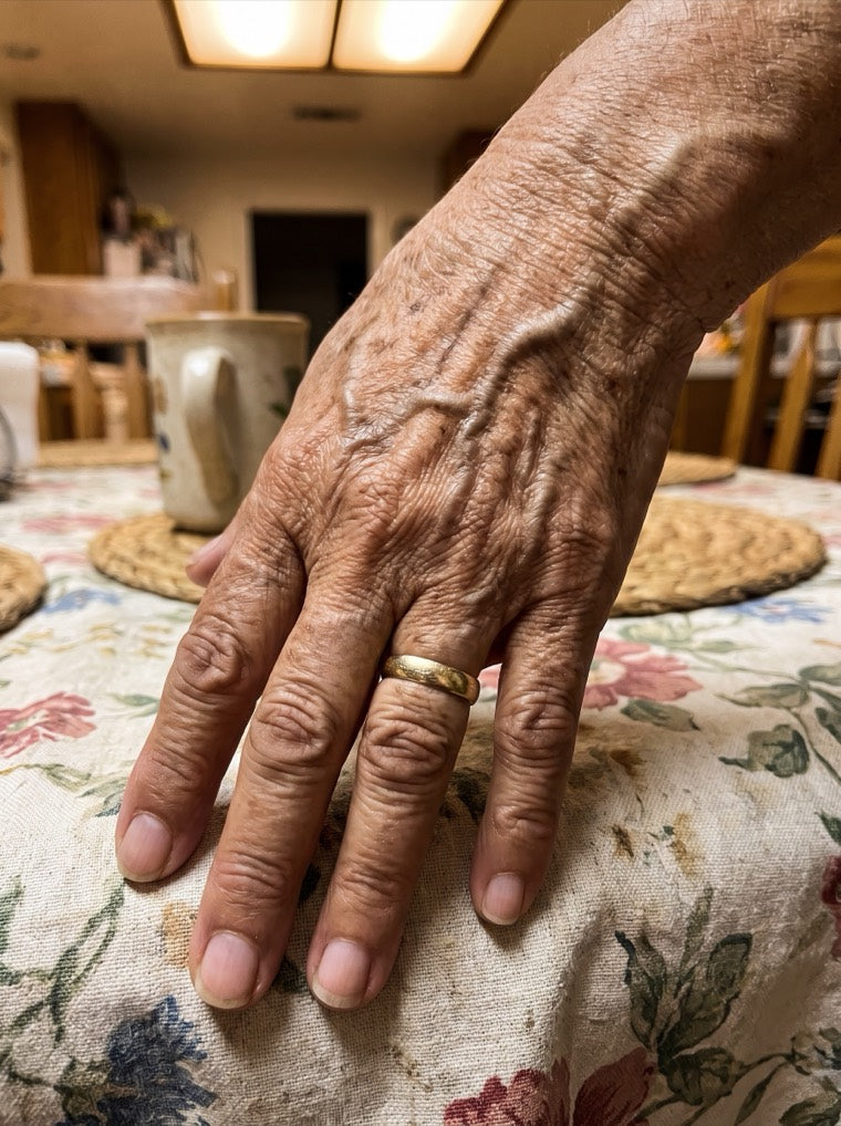 Rosa's deeply wrinkled hand before using YouthLift