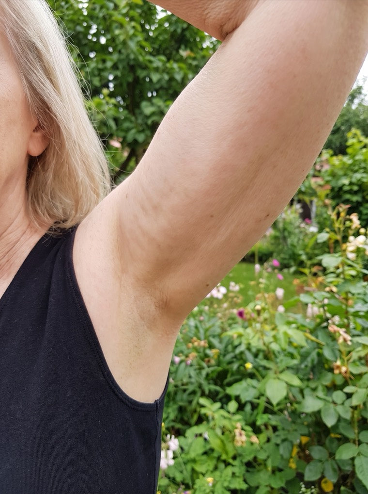 Janet's firmer upper arm after using YouthLift
