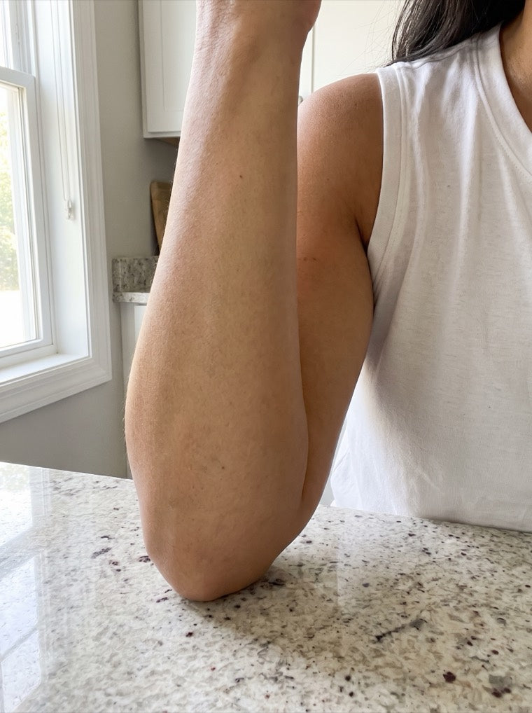 Diane's smoother forearm after using YouthLift