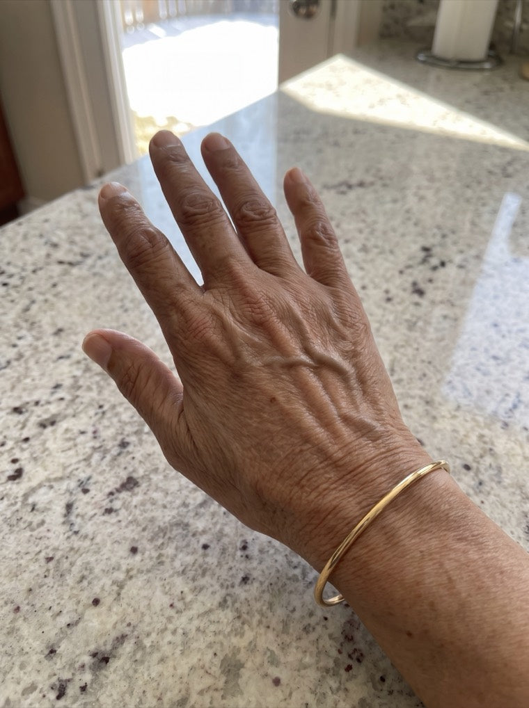 Anita's clear, smoother hand after using YouthLift